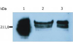 Western Blotting analysis of whole cell lysate of HUT-78 human cutaneous T cell lymphoma cell line. (CD45RA antibody)