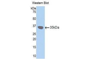 Western Blotting (WB) image for anti-Gap Junction Protein, beta 3, 31kDa (GJB3) (AA 210-270) antibody (ABIN1174655) (Connexin 31 antibody  (AA 210-270))