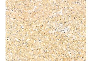 ABIN7094740 and ABIN7098791 at 1/100 staining Rat heart tissue by IHC-P. (DAB2IP antibody  (C-Term))