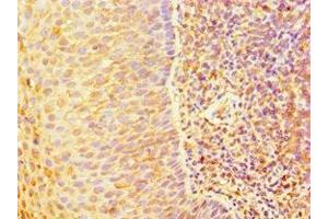 Immunohistochemistry of paraffin-embedded human tonsil tissue using ABIN7144328 at dilution of 1:100 (TAP1 antibody  (AA 524-808))
