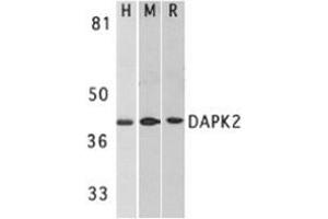 Western blot analysis of DAPK2 in A431 (H), mouse spleen (M), and rat kidney (R) lysates with AP30272PU-N DAPK2 antibody at 1 μg/ml.