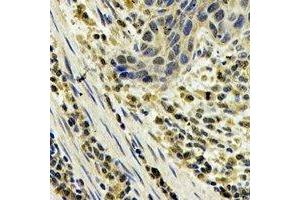 Immunohistochemistry (IHC) image for anti-S100 Calcium Binding Protein A8 (S100A8) antibody (ABIN7308306) (S100A8 antibody)