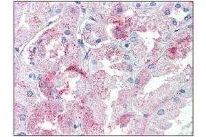 Immunohistochemistry: GPR146 antibody staining of Formalin-Fixed, Paraffin-Embedded Human Kidney. (GPR146 antibody  (Internal Region))