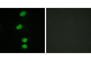 P-peptide - +Immunofluorescence analysis of HeLa cells, using Androgen Receptor (Phospho-Ser94) antibody. (Androgen Receptor antibody  (pSer94))