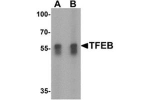 Western blot analysis of TFEB in A549 cell lysate with TFEB antibody at (A) 1 and (B) 2 ug/mL.