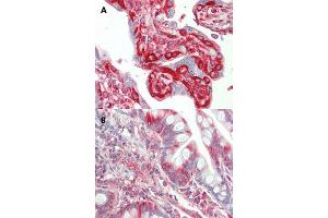 Immunohistochemical staining (Formalin-fixed paraffin-embedded sections) of human placenta (A) and human small intestine (B) with TFG monoclonal antibody, clone TFG-03 . (TFG antibody  (N-Term))
