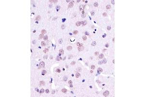 A staining YY1 in Rat brain tissue sections by Immunohistochemistry (IHC-P - paraformaldehyde-fixed, paraffin-embedded sections). (YY1 antibody)