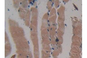 DAB staining on IHC-P; Samples: Mouse Skeletal muscle Tissue (MYH2 antibody  (AA 1238-1472))
