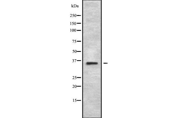 MAGEA2B antibody  (C-Term)