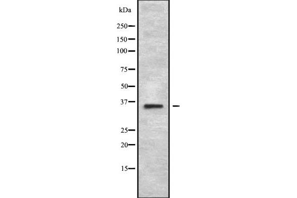 MAGEA2B Antikörper  (C-Term)