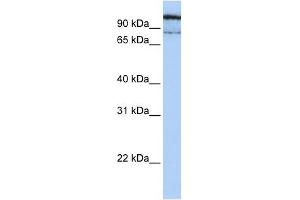 GAA antibody used at 1 ug/ml to detect target protein. (GAA antibody  (N-Term))