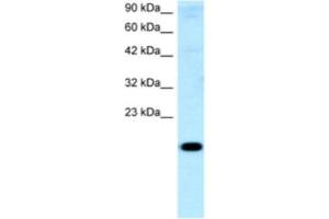 Western Blotting (WB) image for anti-Cbp/p300-Interacting Transactivator, with Glu/Asp-Rich Carboxy-terminal Domain, 1 (CITED1) antibody (ABIN2460540) (CITED1 antibody)