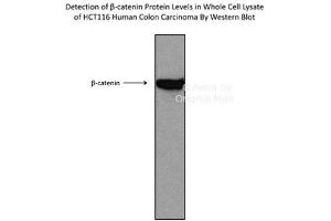 Sample Type :  HCT116 cell lysate CTNNB1 is supported by BioGPS gene expression data to be expressed in HCT116 (CTNNB1 antibody  (C-Term))