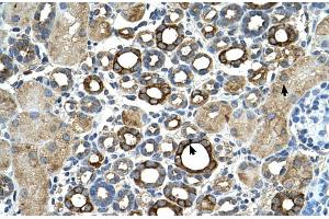 Human kidney (ST14 antibody  (C-Term))
