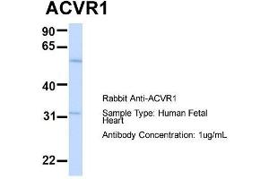 Host:  Rabbit  Target Name:  ACVR1  Sample Type:  Human Fetal Heart  Antibody Dilution:  1. (ACVR1 antibody  (N-Term))