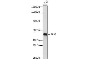 Western blot analysis of extracts of Raji cells, using P antibody (ABIN7269154) at 1:500 dilution. (PAX5 antibody)