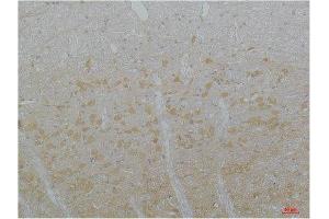 Immunohistochemistry (IHC) analysis of paraffin-embedded Rat Brain Tissue using Cav3. (CACNA1I antibody)