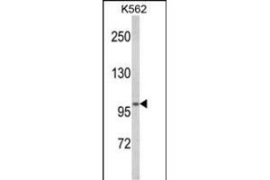 Western blot analysis of ATP12A Antibody (Center) (ABIN652631 and ABIN2842421) in K562 cell line lysates (35 μg/lane).