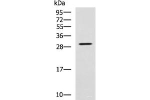 Western blot analysis of SP20 cell lysate using LRAT Polyclonal Antibody at dilution of 1:800 (LRAT antibody)