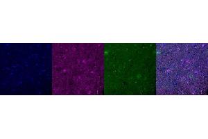 Immunohistochemistry (IHC) image for anti-Microtubule-Associated Protein 2 (MAP2) antibody (ABIN7456240) (MAP2 antibody)