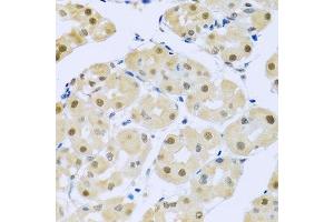 Immunohistochemistry of paraffin-embedded human stomach using SMEK1 antibody. (SMEK1 antibody  (AA 395-594))
