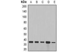 Western blot analysis of Cyclin D2 expression in SW480 (A), NIH3T3 (B), mouse brain (C), mouse lung (D), rat heart (E) whole cell lysates.