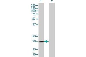 Lane 1: AHNAK transfected lysate ( 16. (AHNAK 293T Cell Transient Overexpression Lysate(Denatured))