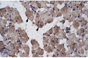 Immunohistochemical staining (Formalin-fixed paraffin-embedded sections) of human muscle with LHX9 polyclonal antibody . (LHX9 antibody  (AA 324-373))