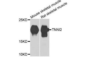 Western blot analysis of extracts of various cell lines, using TNNI2 antibody. (TNNI2 antibody  (AA 1-100))