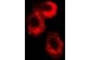 Immunofluorescent analysis of RISP staining in U2OS cells. (UQCRFS1 antibody)