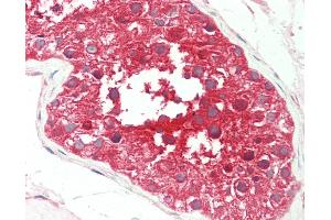 Anti-SPAG9 antibody IHC staining of human testis. (SPAG9 antibody  (AA 1-50))