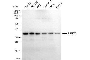 anti-Leucine Rich Repeat Containing 3 (LRRC3) antibody