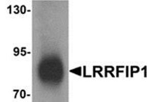 Western blot analysis of LRRFIP1 in human colon tissue lysate with LRRFIP1 antibody at 1 μg/ml. (LRRFIP1 antibody  (C-Term))