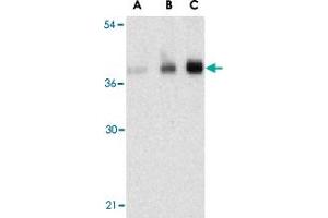 Western blot analysis of C1QTNF5 in human brain tissue lysate with C1QTNF5 polyclonal antibody  at (A) 1, (B) 2, and (C) 4 ug/mL .