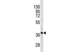 Western Blotting (WB) image for anti-Chemokine (C-X-C Motif) Receptor 4 (CXCR4) (AA 50-79) antibody (ABIN3030512)