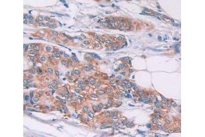 Used in DAB staining on fromalin fixed paraffin- embedded Kidney tissue (TPM2 antibody  (AA 1-284))