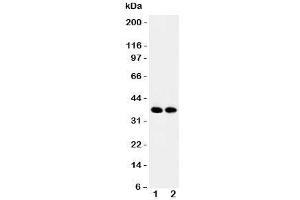Western blot testing of APEX1 antibody and Lane 1:  rat brain;  2: mouse brain tissue lysate. (APEX1 antibody  (Middle Region))