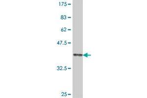 COL11A2 antibody  (AA 29-128)