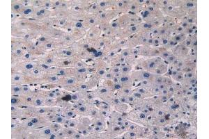 Immunohistochemistry (IHC) image for anti-Adrenergic, Beta, Receptor Kinase 1 (ADRBK1) (AA 398-640) antibody (ABIN7440779)