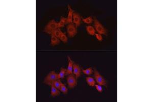 Immunofluorescence analysis of PC-12 cells using T Rabbit pAb (ABIN6130537, ABIN6143503, ABIN6143504 and ABIN6215581) at dilution of 1:50 (40x lens). (MAP3K7 antibody  (AA 300-470))