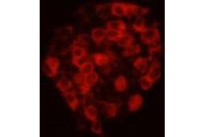 Immunocytochemistry (ICC) image for anti-Cadherin EGF LAG Seven Pass G-Type Receptor 2 (CELSR2) antibody (ABIN1112870) (CELSR2 antibody)