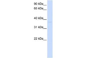 GDAP1L1 antibody used at 1 ug/ml to detect target protein. (GDAP1L1 antibody  (N-Term))