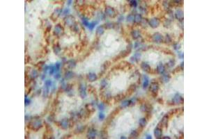 Used in DAB staining on fromalin fixed paraffin-embedded Kidney tissue (CHD3 antibody  (AA 1551-1742))