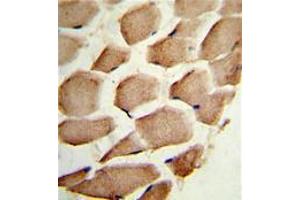 Image no. 2 for anti-Actin Related Protein 2/3 Complex, Subunit 1A, 41kDa (ARPC1A) (C-Term) antibody (ABIN452762) (ARPC1A antibody  (C-Term))