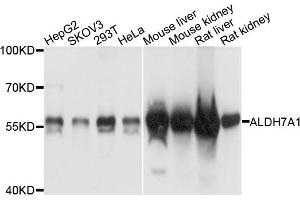 Western blot analysis of extracts of various cells, using ALDH7A1 antibody. (ALDH7A1 antibody)