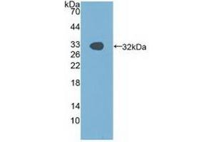 Detection of Recombinant PAK1, Human using Polyclonal Antibody to p21 Protein Activated Kinase 1 (PAK1)