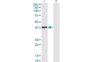 Western Blot analysis of HHEX expression in transfected 293T cell line by HHEX monoclonal antibody (M02), clone 1A5. (HHEX antibody  (AA 1-270))