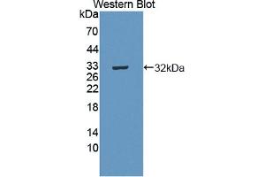 Detection of Recombinant MERTK, Human using Polyclonal Antibody to C-Mer Proto Oncogene Tyrosine Kinase (MERTK) (MERTK antibody  (AA 587-858))