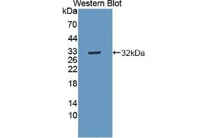 Detection of Recombinant MERTK, Human using Polyclonal Antibody to C-Mer Proto Oncogene Tyrosine Kinase (MERTK)