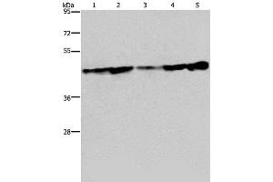 Western Blot analysis of Human fetal liver tissue, HT-29 and HUVEC cell, MCF-7 cell and Human hepatocellular carcinoma tissue using CERS4 Polyclonal Antibody at dilution of 1:300 (LASS4 antibody)